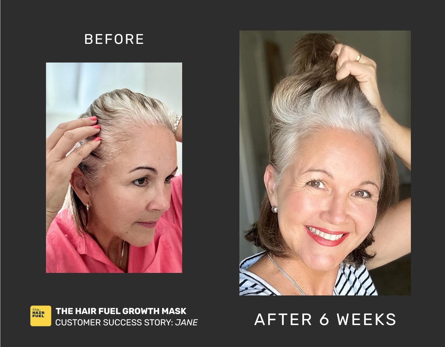 Hair growth success story: Jane - The Hair Fuel