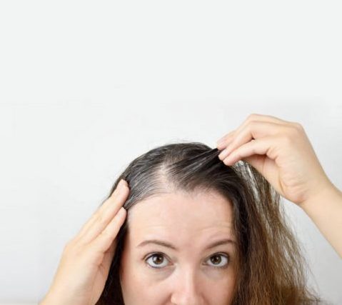 9 Ways to Stop Hair Thinning (and 2 Things that will never work) - The Hair Fuel