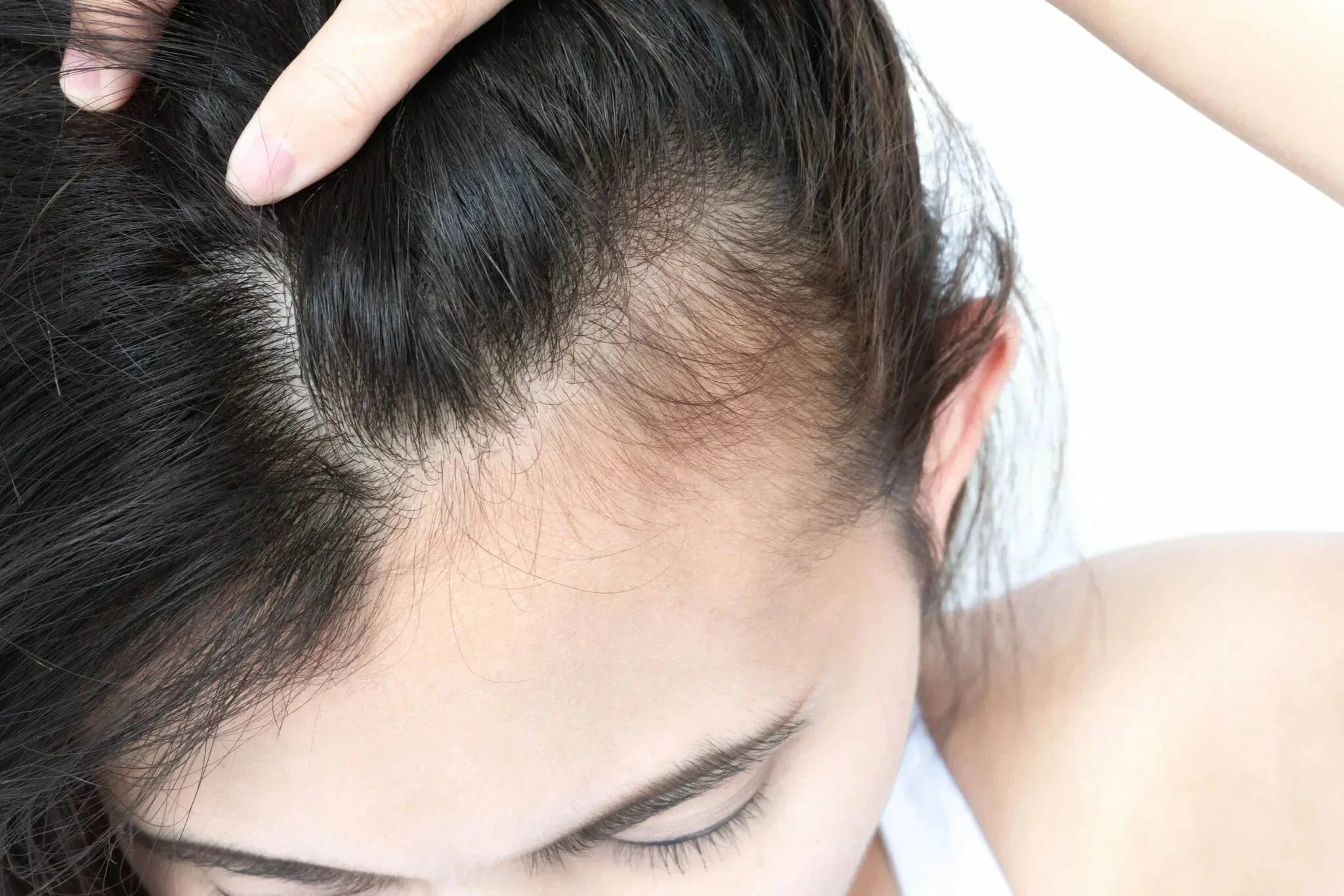 Understanding Dead Hair Follicles: Causes, Signs, and Solutions - The Hair Fuel