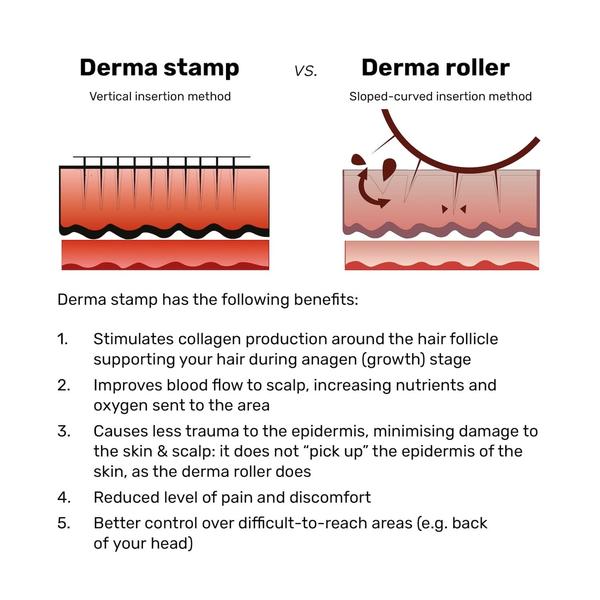 Dermastamp for Hair Regrowth – Microneedling ToolThe Hair Fuel