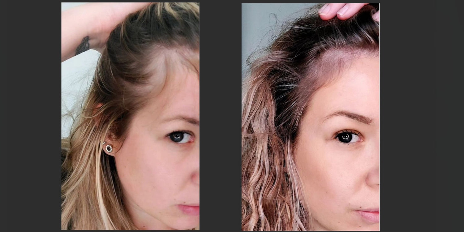 Hair Growth Mask for Thinning Hair &amp; Scalp Health
