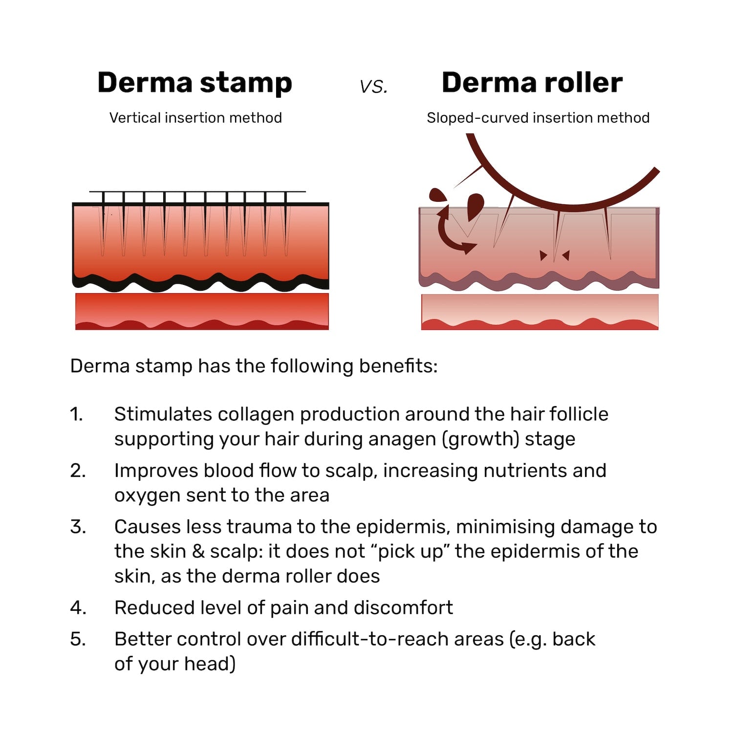 dermastamp vs derma roller