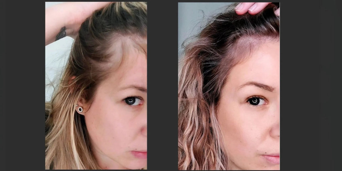 Hair Growth Mask for Thinning Hair &amp; Scalp HealthThe Hair Fuel